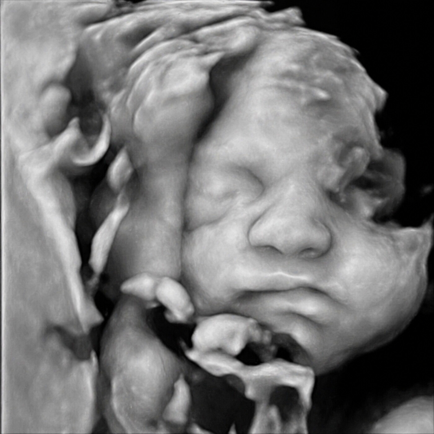 Original 3D ultrasound scan input — sepia voxel rendering from a hospital ultrasound machine