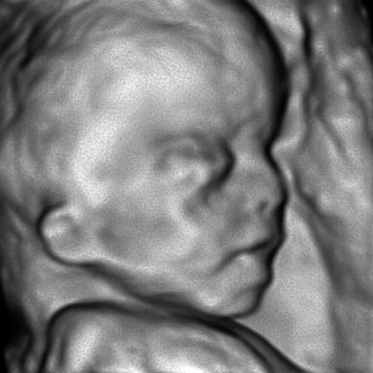 Original 3D ultrasound — Side profile · 3D scan
