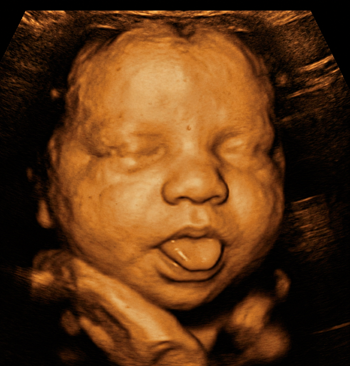 The source 3D ultrasound scan a parent uploaded — the before frame of a studio keepsake session